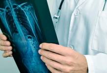 Cáncer en Argentina: 40% de los casos podrían prevenirse evitando factores de riesgo claves